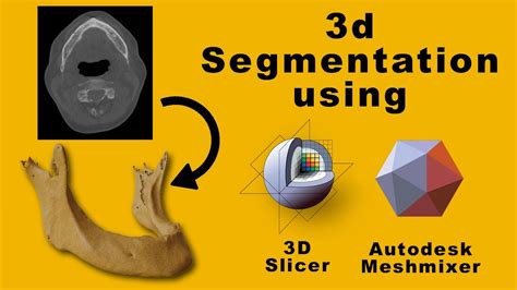DICOM segmentation and STL creation for 3D .